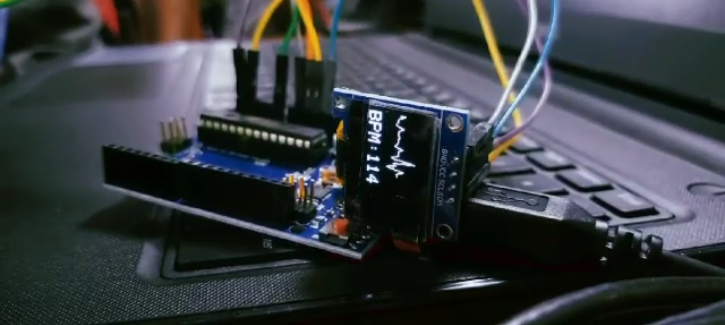 Heartbeat Monitoring System